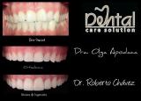 Ortodoncia y Diseño de Sonrisa