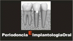 Periodoncia e Implantologia Oral